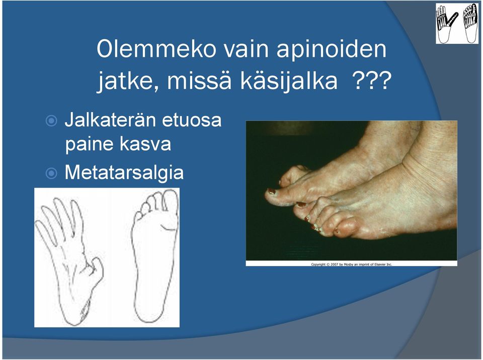 ?? Jalkaterän etuosa