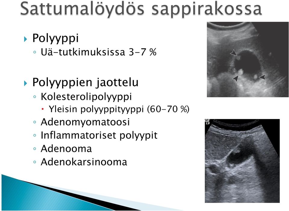 Yleisin polyyppityyppi (60-70 %)