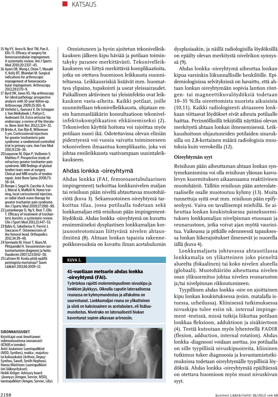 Hip arthroscopy for labral pathology: prospective analysis with 10-year follow-up. Arthroscopy 2009;25:365 8. 18 Verhelst L, Guevara V, De Schepper J, Van Melkebeek J, Pattyn C, Audenaert EA.