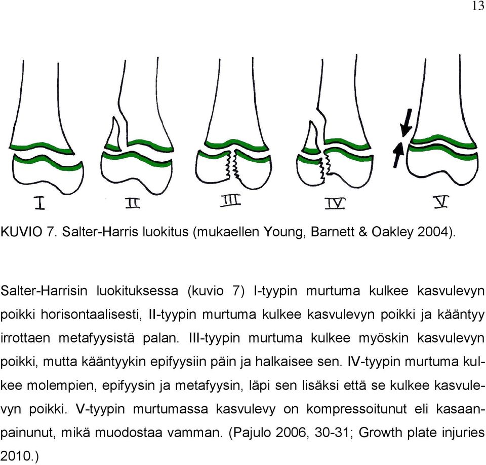 irrottaen metafyysistä palan. III-tyypin murtuma kulkee myöskin kasvulevyn poikki, mutta kääntyykin epifyysiin päin ja halkaisee sen.