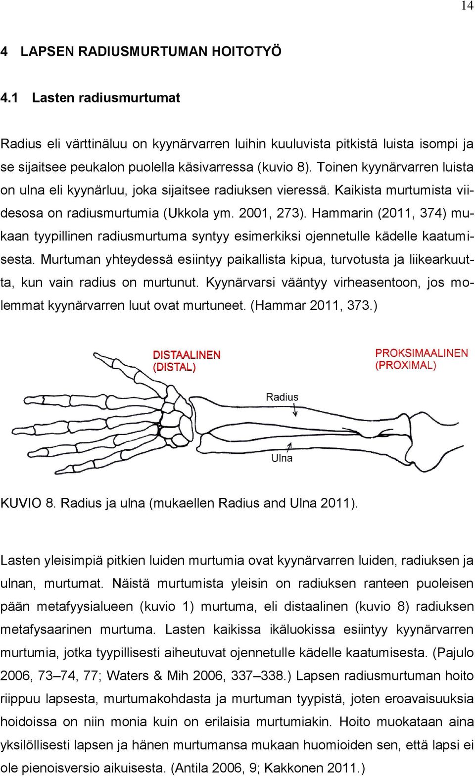 Hammarin (2011, 374) mukaan tyypillinen radiusmurtuma syntyy esimerkiksi ojennetulle kädelle kaatumisesta.