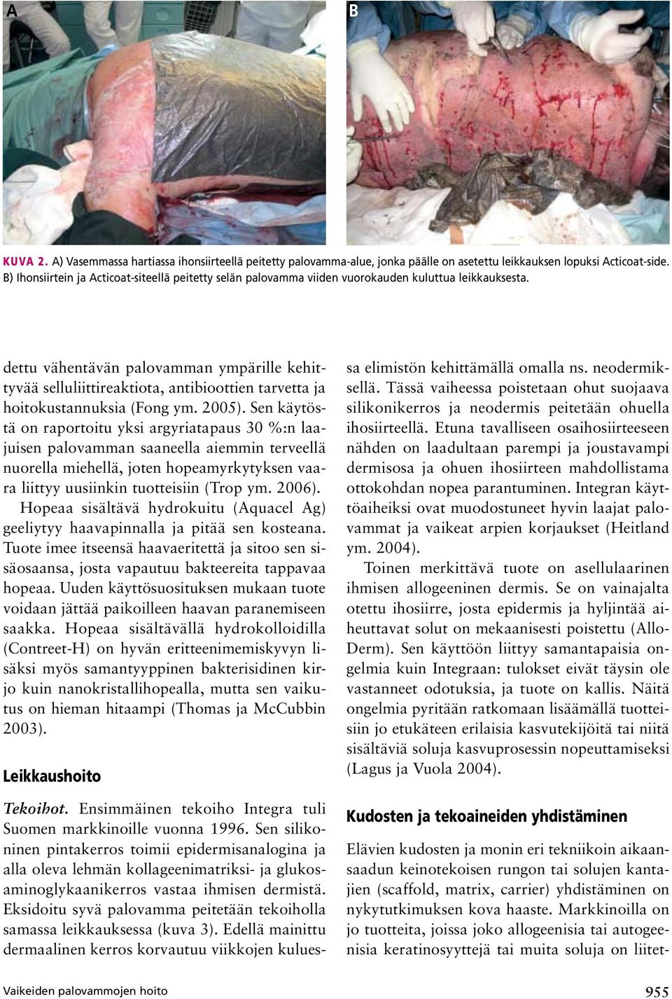 dettu vähentävän palovamman ympärille kehittyvää selluliittireaktiota, antibioottien tarvetta ja hoitokustannuksia (Fong ym. 2005).