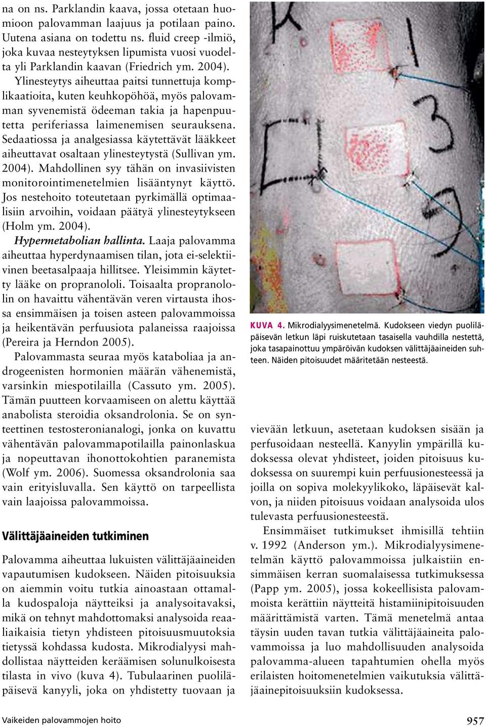 Ylinesteytys aiheuttaa paitsi tunnettuja komplikaatioita, kuten keuhkopöhöä, myös palovamman syvenemistä ödeeman takia ja hapenpuutetta periferiassa laimenemisen seurauksena.