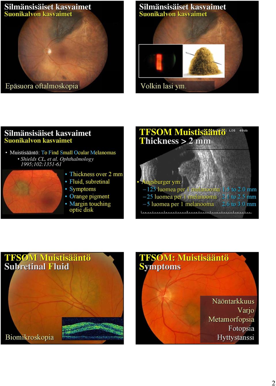 Ophthalmology 1995;102:1351-61 Thickness over 2 mm Fluid, subretinal Symptoms Orange pigment Margin touching optic disk TFSOM Muistisääntö Thickness > 2 mm Augsburger