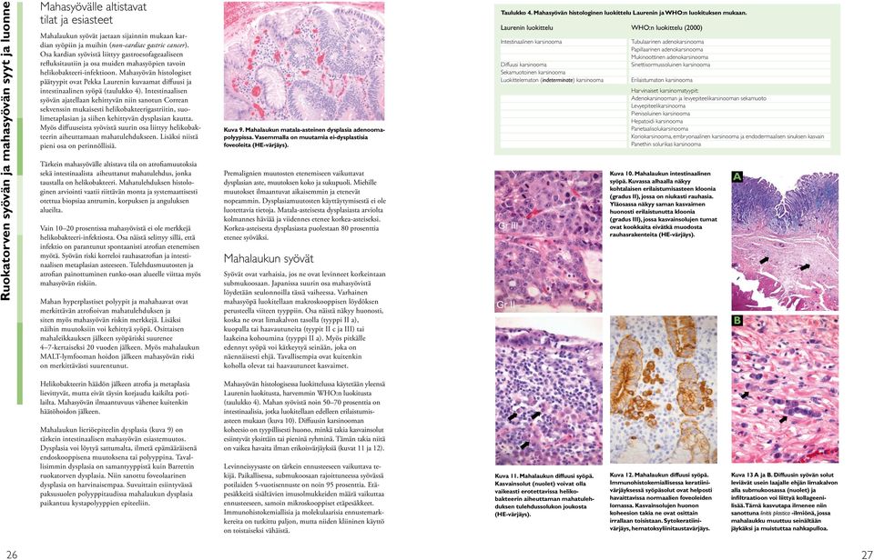 Mahasyövän histologiset päätyypit ovat Pekka Laurenin kuvaamat diffuusi ja intestinaalinen syöpä (taulukko 4).