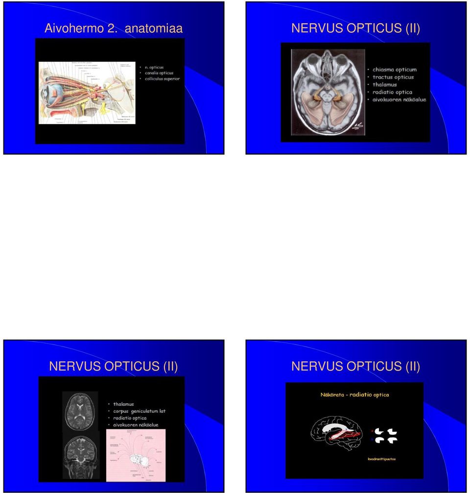 OPTICUS (II) NERVUS