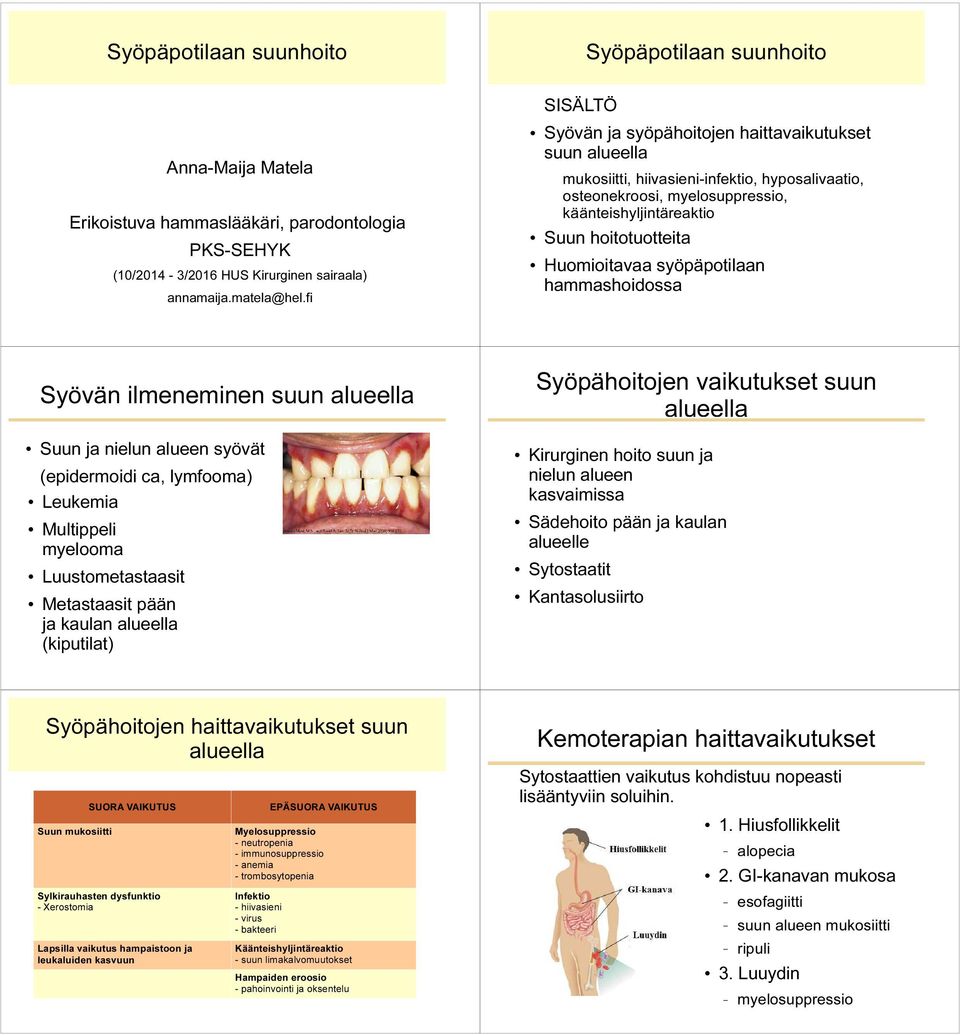 syöpäpotilaan hammashoidossa Syövän ilmeneminen Suun ja nielun alueen syövät (epidermoidi ca, lymfooma) Leukemia Multippeli myelooma Luustometastaasit Metastaasit pään ja kaulan alueella (kiputilat)