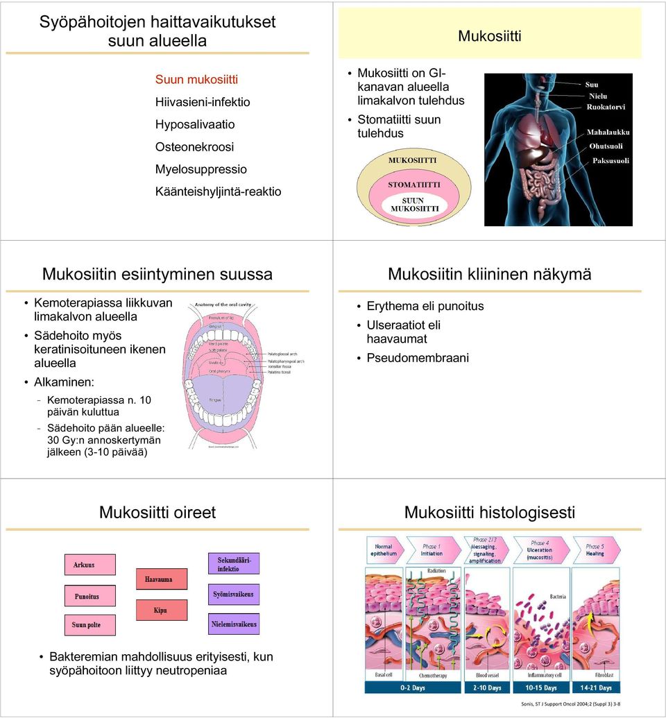 10 päivän kuluttua Sädehoito pään alueelle: 30 Gy:n annoskertymän jälkeen (3-10 päivää) Erythema eli punoitus Ulseraatiot eli haavaumat Pseudomembraani