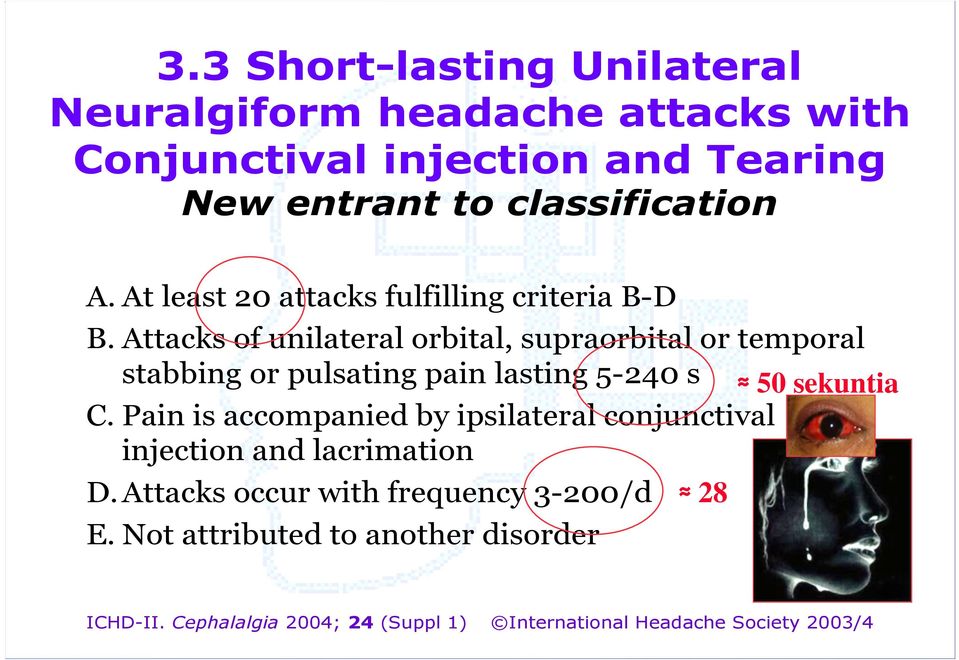 Attacks of unilateral orbital, supraorbital or temporal stabbing or pulsating pain lasting 5-240 s 50 sekuntia C.