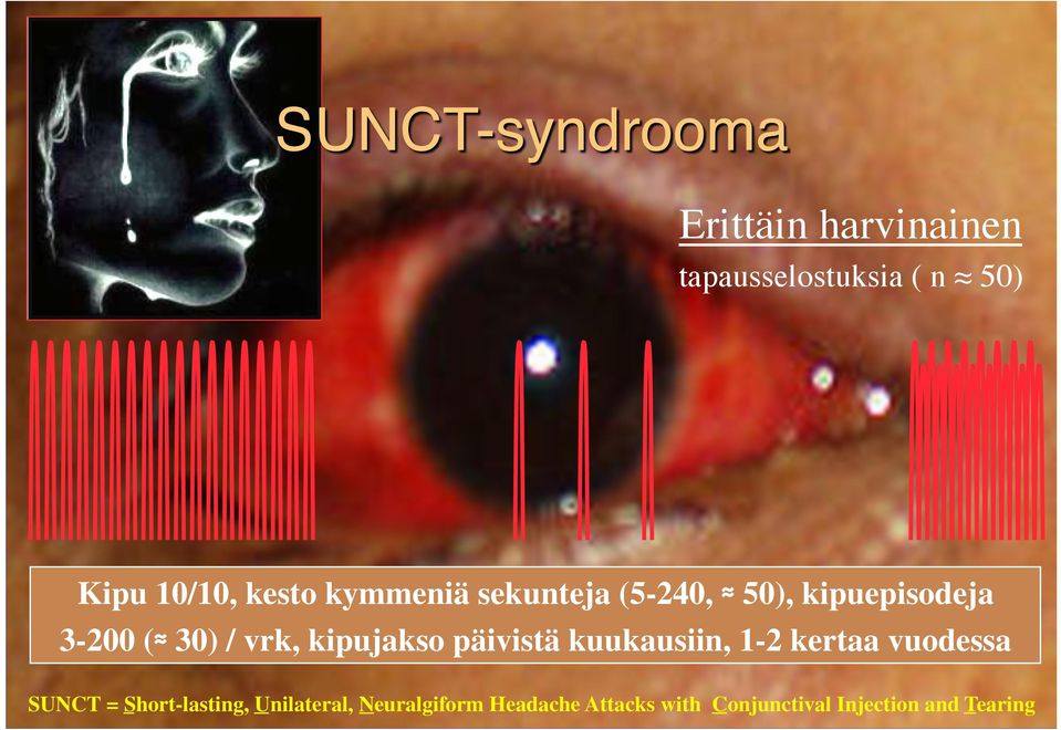 30) / vrk, kipujakso päivistä kuukausiin, 1-2 kertaa vuodessa SUNCT =