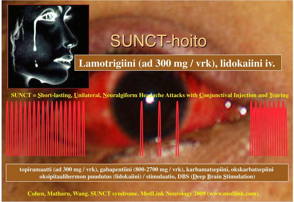 Tearing topiramaatti (ad 300 mg / vrk), gabapentiini (800-2700 mg / vrk), karbamatsepiini,