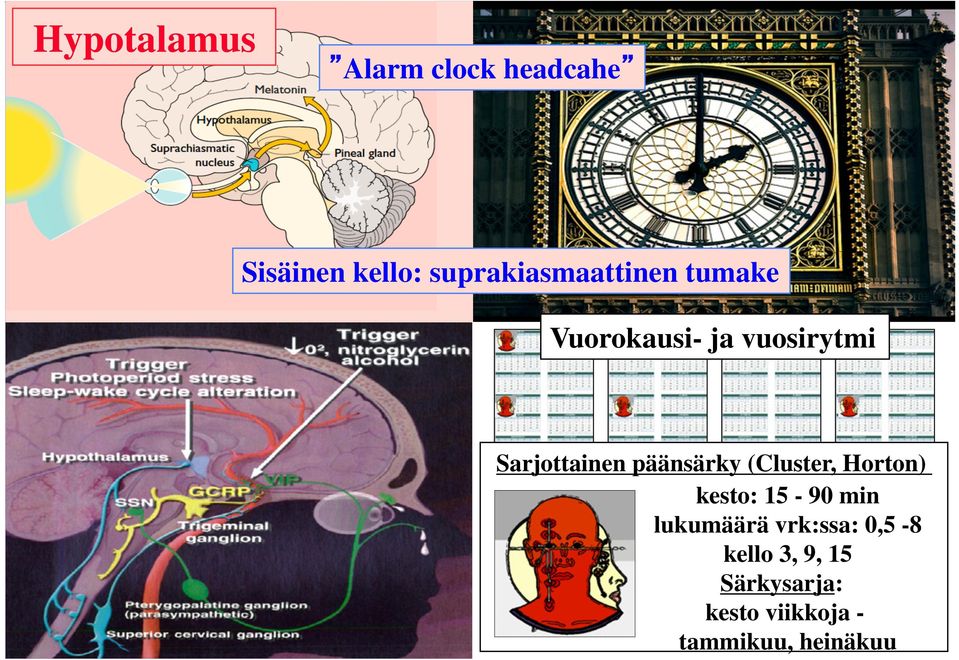 Sarjottainen päänsärky (Cluster, Horton) kesto: 15-90 min