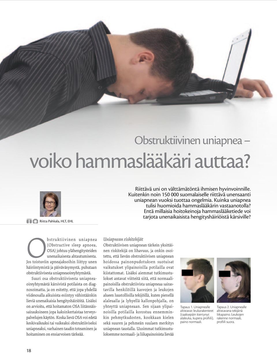 Entä millaisia hoitokeinoja hammaslääketiede voi tarjota unenaikaisista hengityshäiriöistä kärsiville?