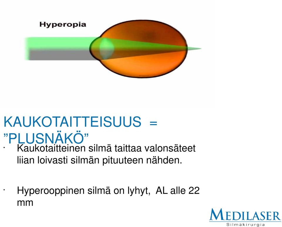 valonsäteet liian loivasti silmän