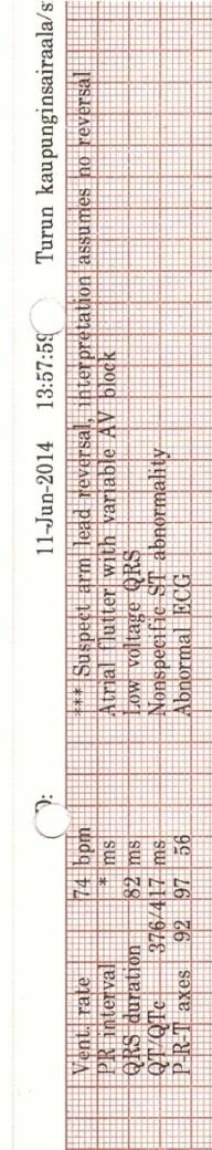 24 puuttui 22 % (n=13) EKG-käyristä. Yksi (n=1) EKG-käyrä oli nimetön (Kuvio 4.). (Taulukko 2.) Taulukko 2.