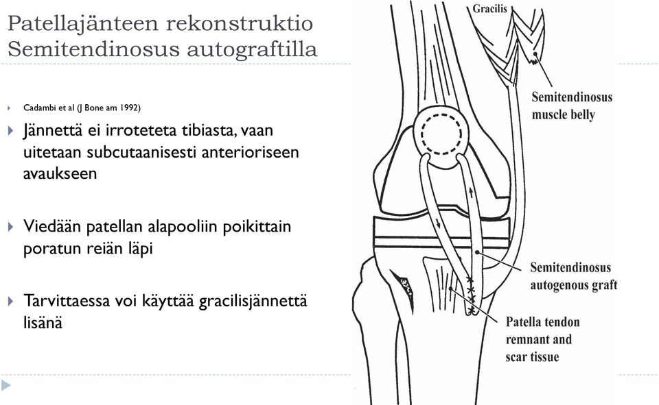 subcutaanisesti anterioriseen avaukseen } Viedään patellan alapooliin