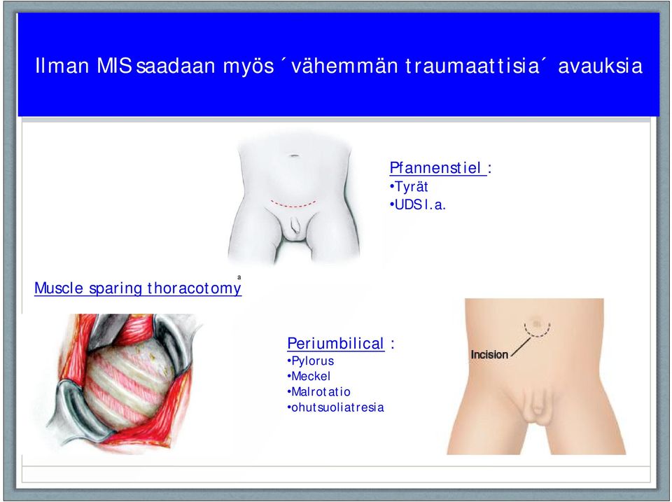 Tyrät UDS l.a.