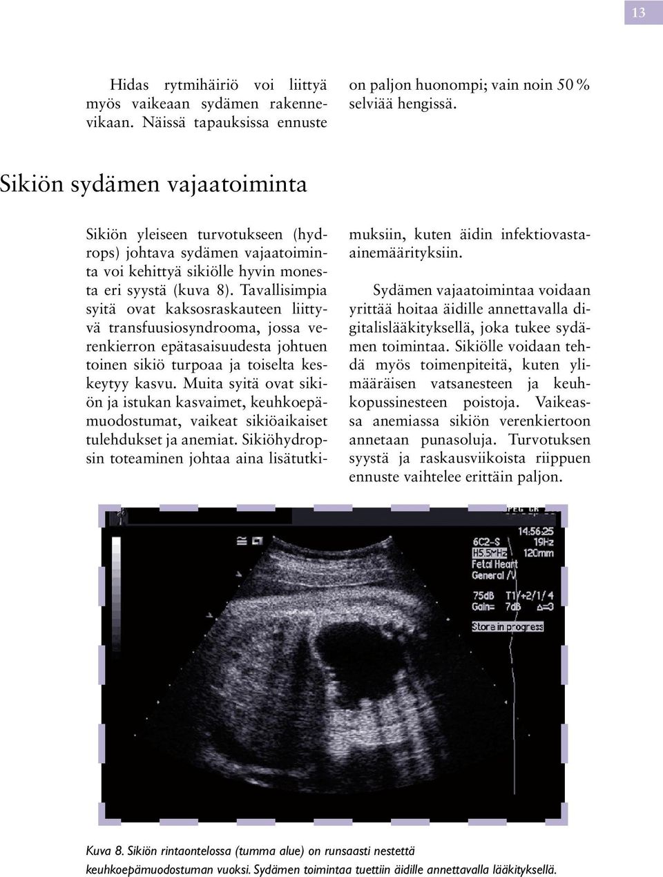 Tavallisimpia syitä ovat kaksosraskauteen liittyvä transfuusiosyndrooma, jossa verenkierron epätasaisuudesta johtuen toinen sikiö turpoaa ja toiselta keskeytyy kasvu.