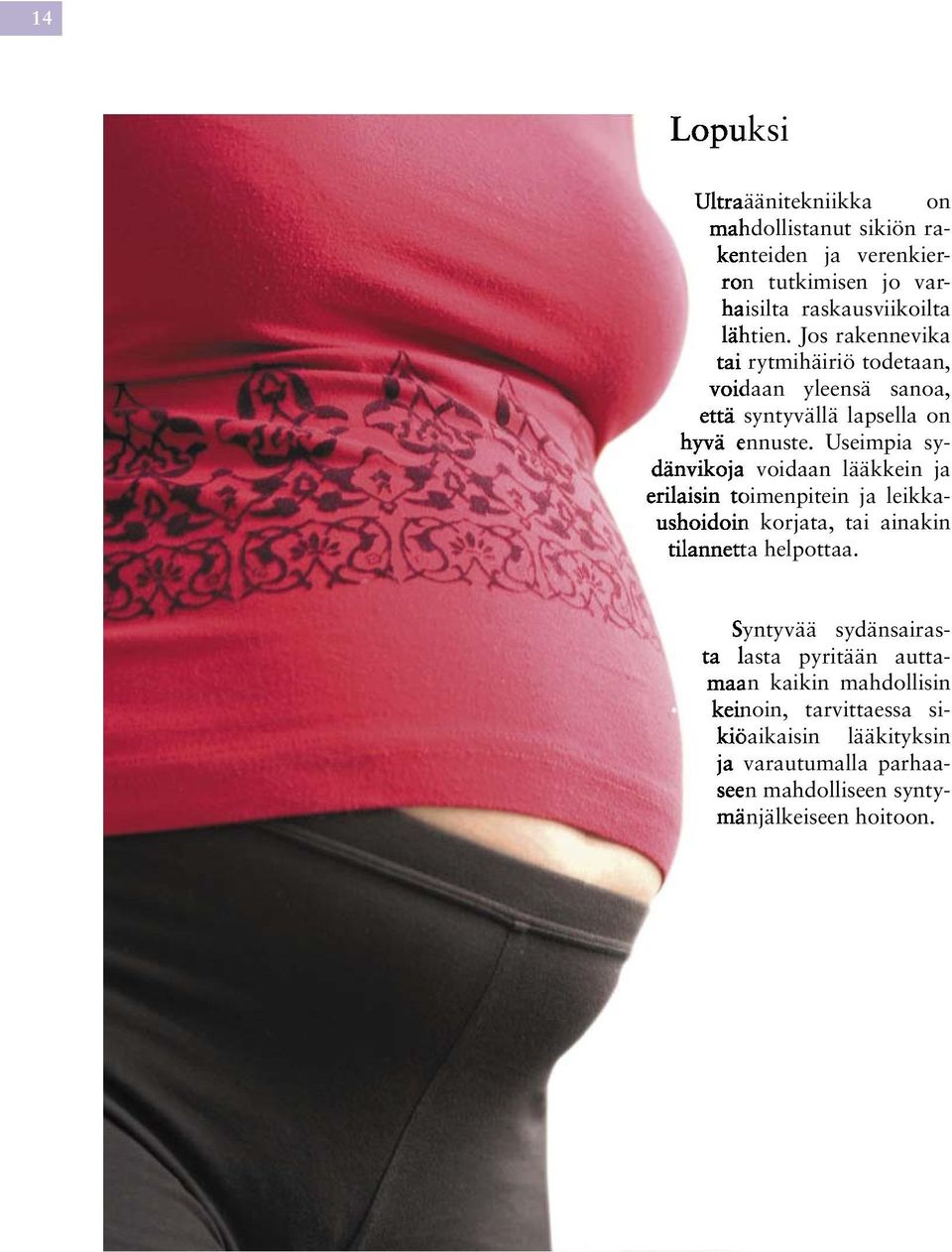 Useimpia sya voidaan lääkkein ja oimenpitein ja leikkan korjata, tai ainakin ta helpottaa.