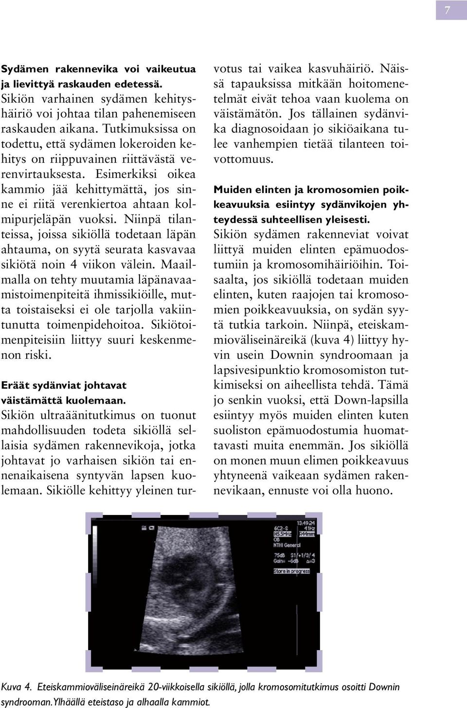 Esimerkiksi oikea kammio jää kehittymättä, jos sinne ei riitä verenkiertoa ahtaan kolmipurjeläpän vuoksi.