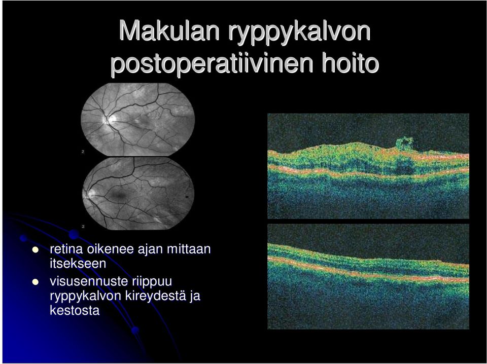 oikenee ajan mittaan itsekseen