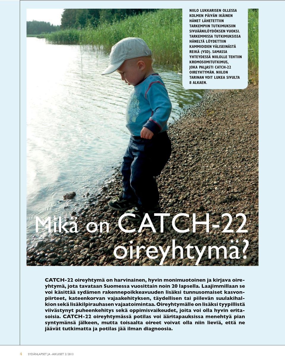 CATCH-22 oireyhtymä on harvinainen, hyvin monimuotoinen ja kirjava oire- yhtymä, jota tavataan Suomessa vuosittain noin 20 lapsella.