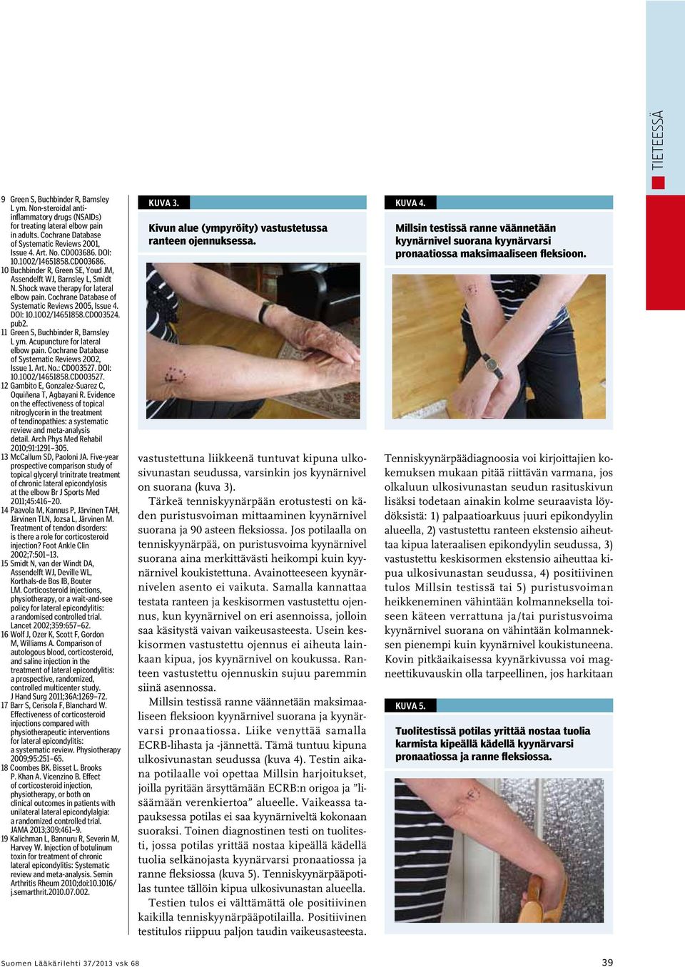 Cochrane Database of Systematic Reviews 2005, Issue 4. DOI: 10.1002/14651858.CD003524. pub2. 11 Green S, Buchbinder R, Barnsley L ym. Acupuncture for lateral elbow pain.