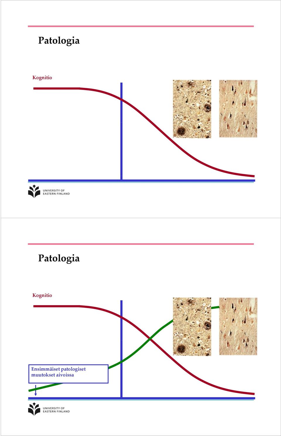 patologiset muutokset