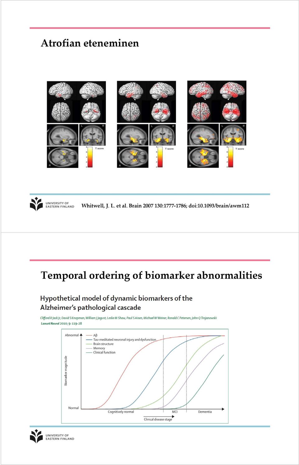 Brain 2007 130:1777 1786; doi:10.