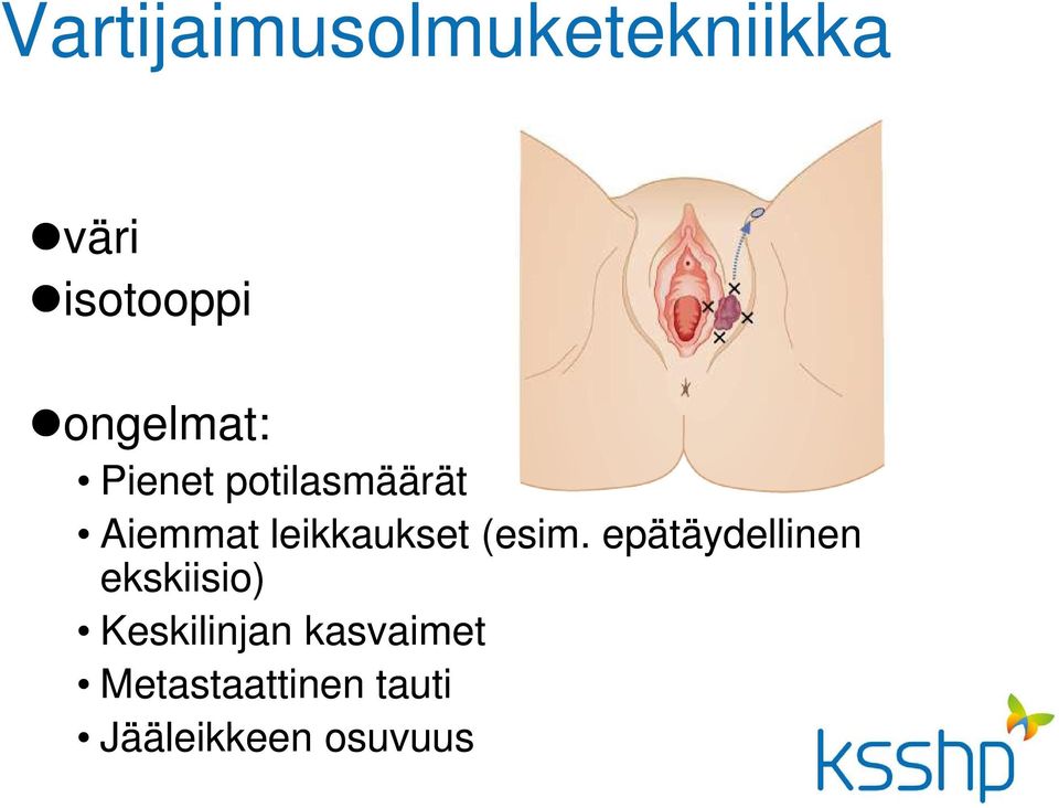 leikkaukset (esim.