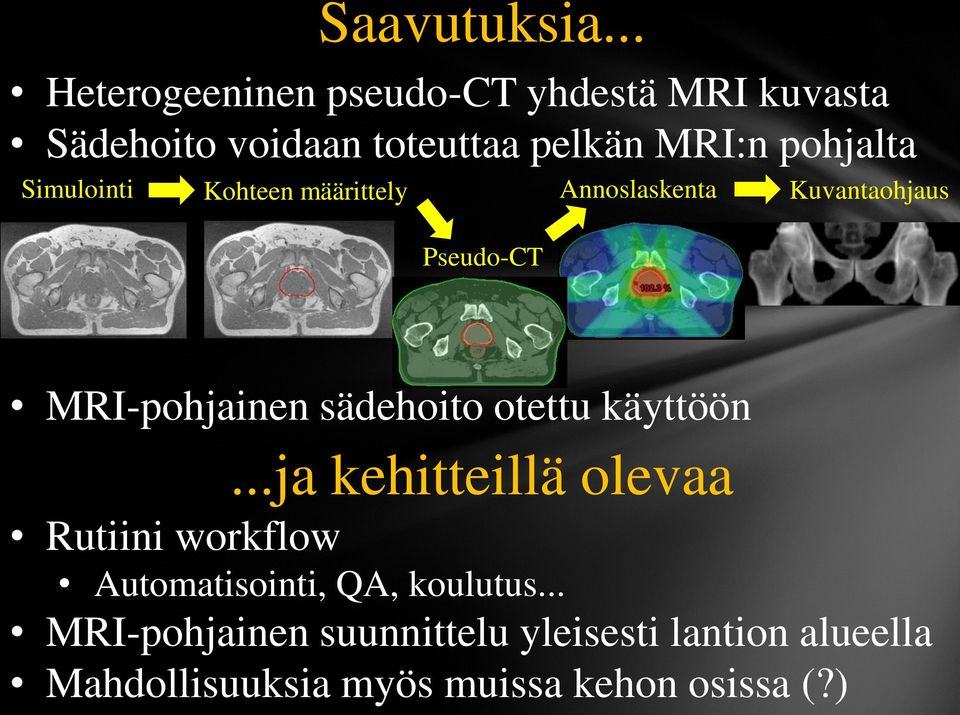 pohjalta Simulointi Kohteen määrittely Annoslaskenta Kuvantaohjaus Pseudo-CT MRI-pohjainen