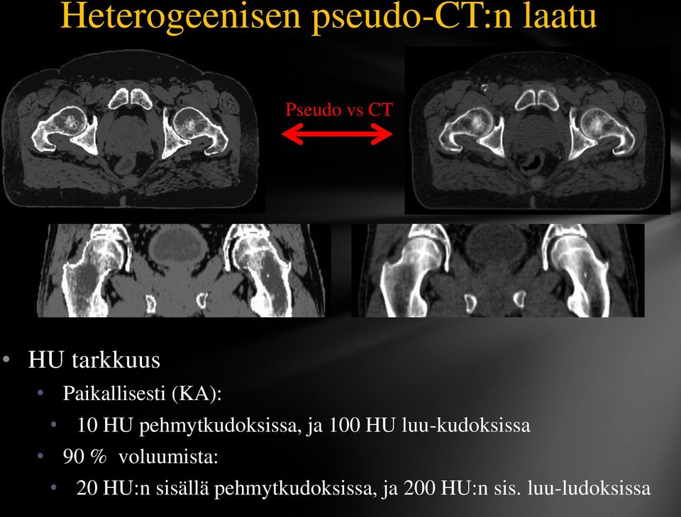 ja 100 HU luu-kudoksissa 90 % voluumista: 20 HU:n