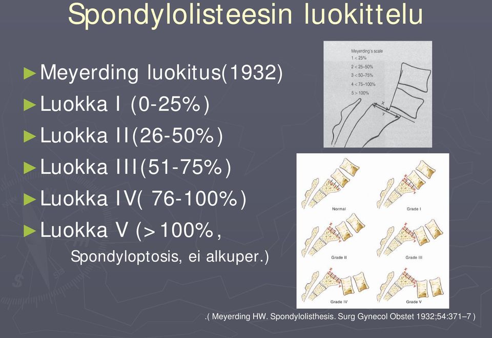 76-100%) Luokka V (>100%, Spondyloptosis, ei alkuper.).( Meyerding HW.