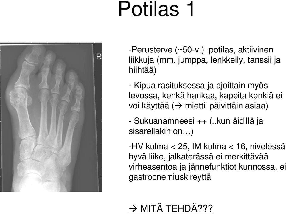 kenkiä ei voi käyttää ( miettii päivittäin asiaa) - Sukuanamneesi ++ (.