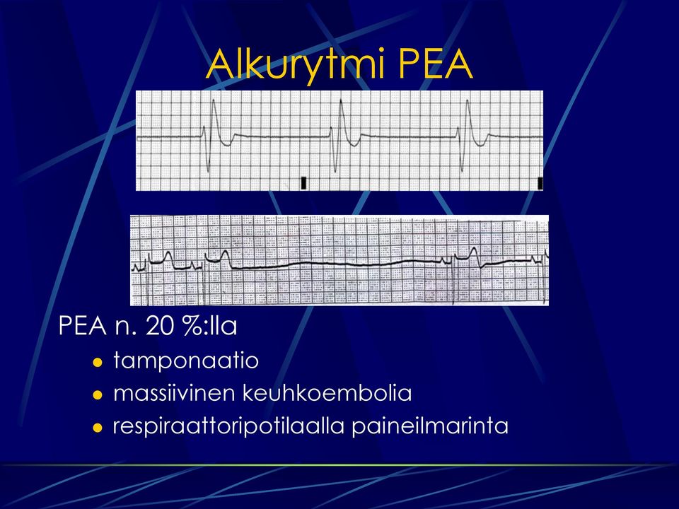 Anestesian aikainen elvytys ja tapausselostus - PDF Free Download