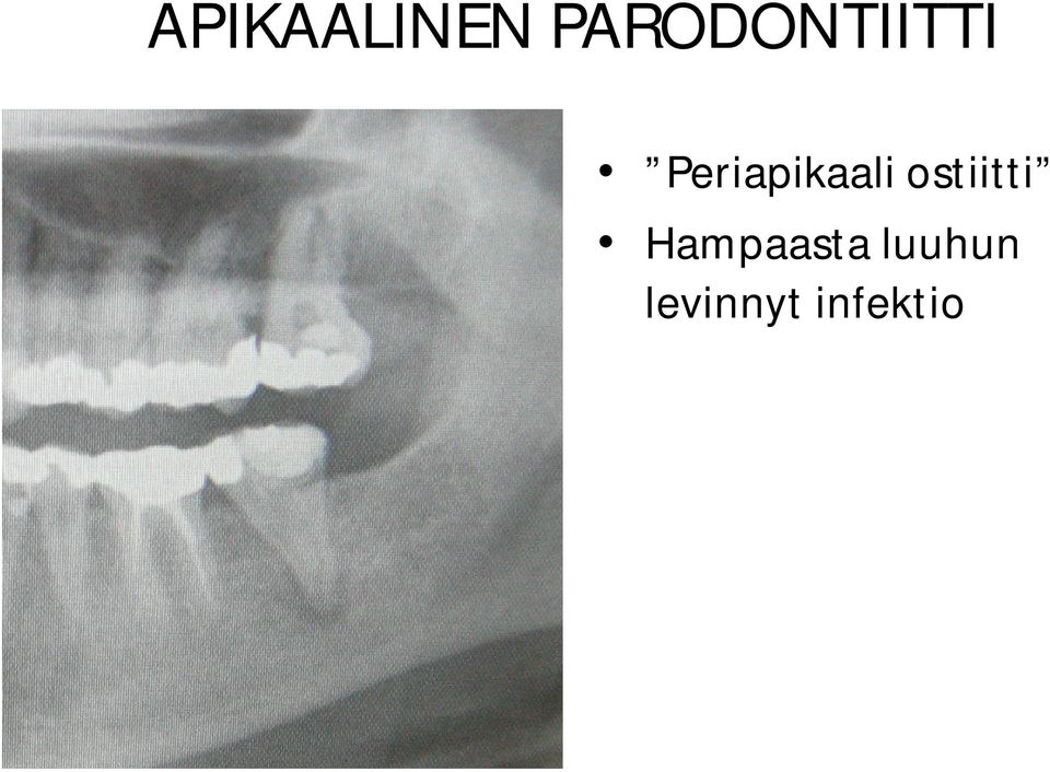 Periapikaali