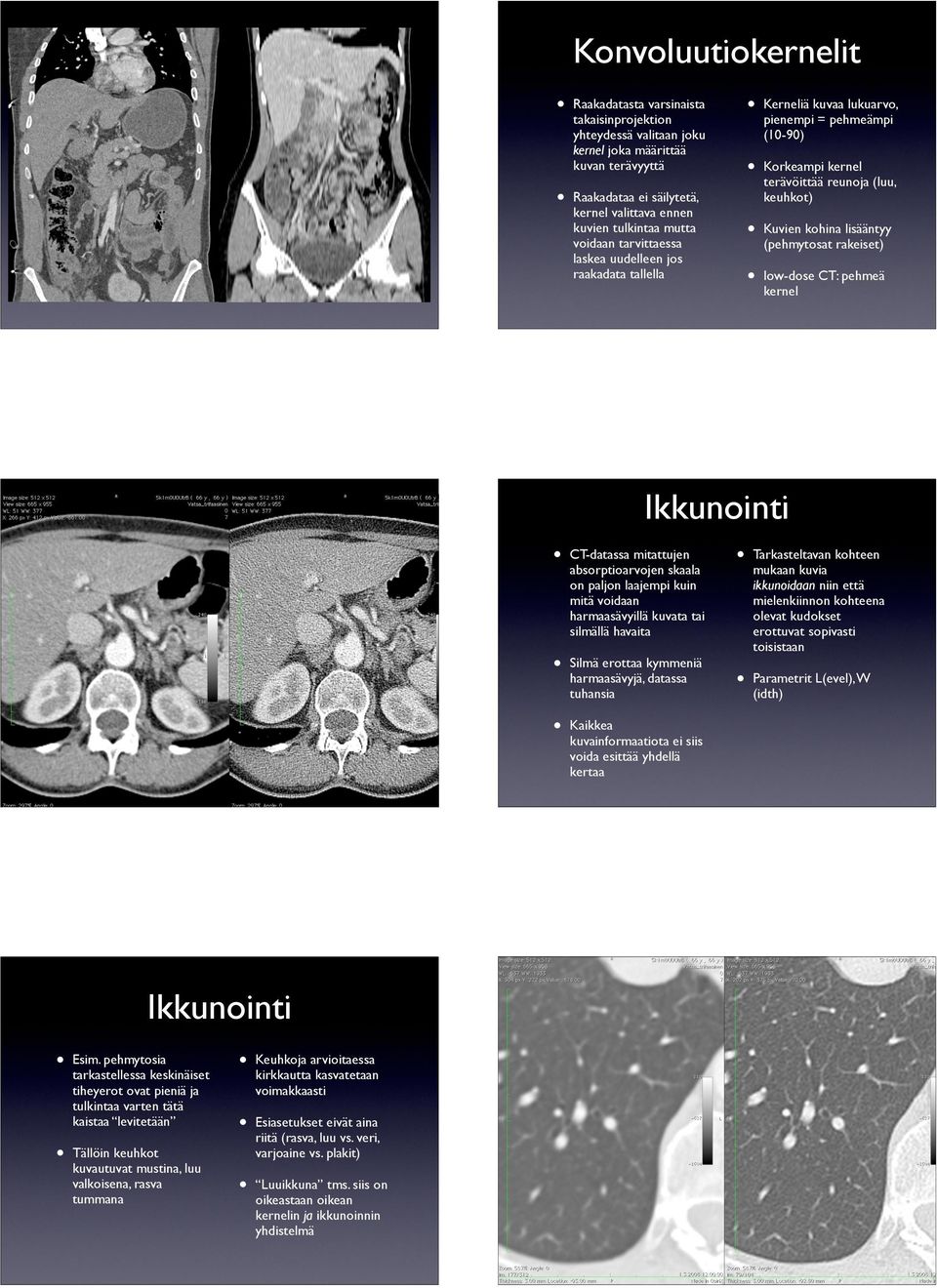 (pehmytosat rakeiset) low-dose CT: pehmeä kernel Ikkunointi Ikkunointi Esim.