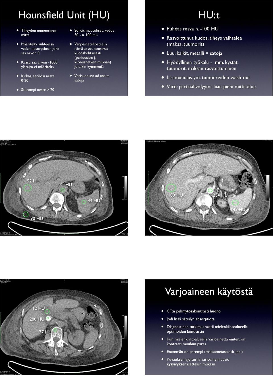 -100 HU Rasvoittunut kudos, tiheys vaihtelee (maksa, tuumorit) Luu, kalkit, metalli = satoja Hyödyllinen työkalu - mm. kystat, tuumorit, maksan rasvoittuminen Lisämunuais ym.