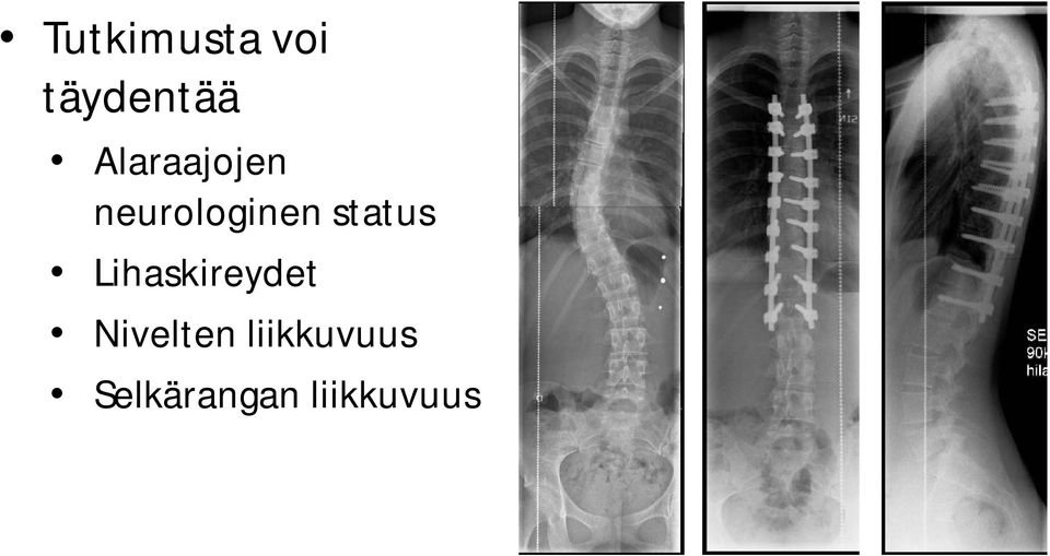 status Lihaskireydet