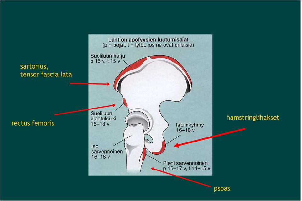 lata rectus