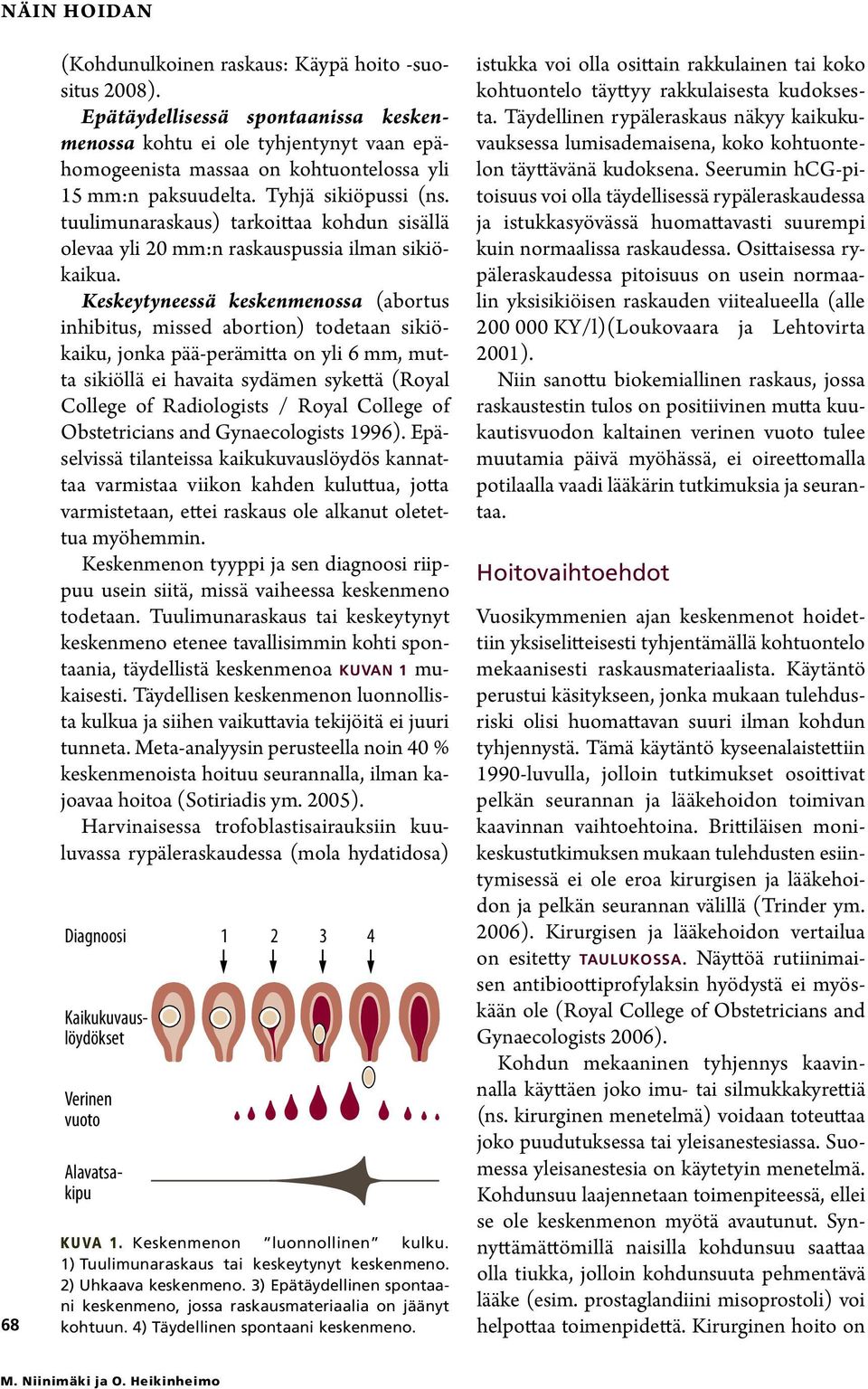 tuulimunaraskaus) tarkoittaa kohdun sisällä olevaa yli 20 mm:n raskauspussia ilman sikiökaikua.