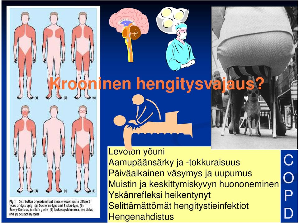 Päiväaikainen väsymys ja uupumus Muistin ja