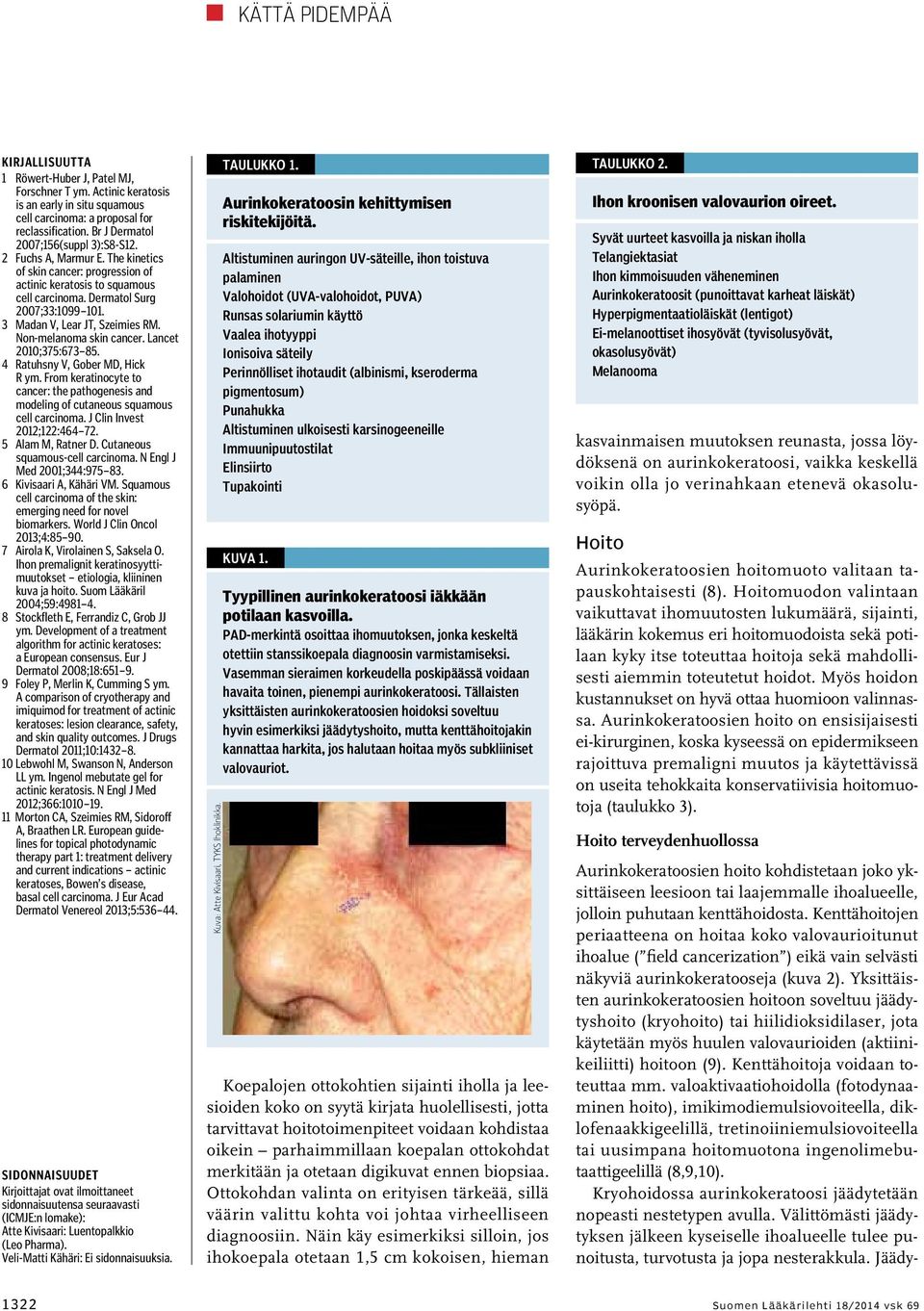 Non-melanoma skin cancer. Lancet 2010;375:673 85. 4 Ratuhsny V, Gober MD, Hick R ym. From keratinocyte to cancer: the pathogenesis and modeling of cutaneous squamous cell carcinoma.