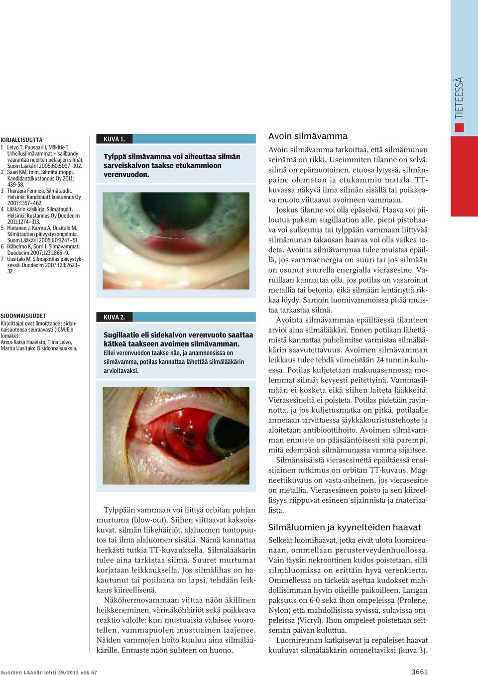 5 Hietanen J, Karma A, Uusitalo M. Silmätautien päivystysongelmia. Suom Lääkäril 2005;60:3247 51. 6 Ikäheimo K, Sorri I. Silmävammat. Duodecim 2007;123:1865 9. 7 Uusitalo M.