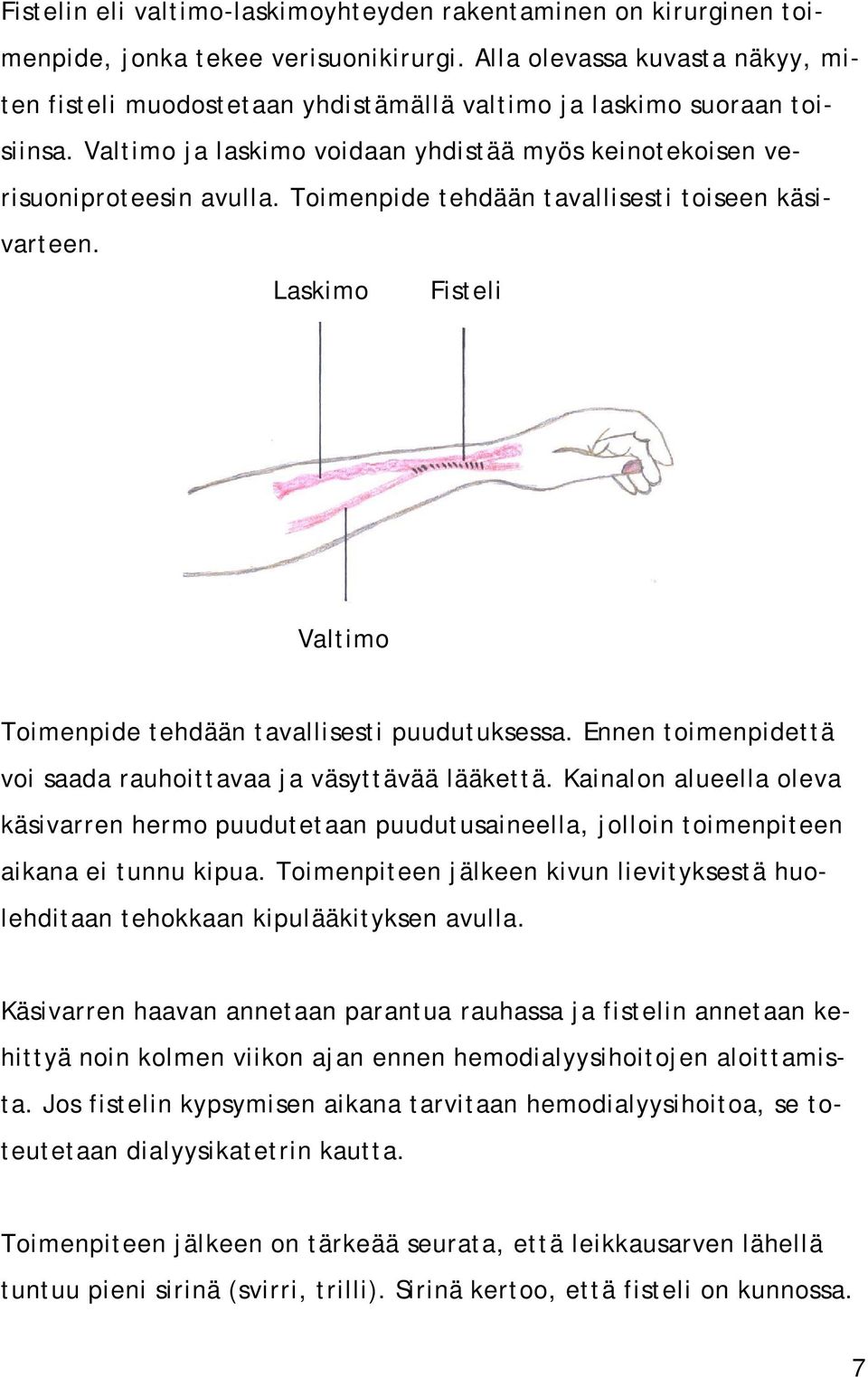 Toimenpide tehdään tavallisesti toiseen käsivarteen. Laskimo Fisteli Valtimo Toimenpide tehdään tavallisesti puudutuksessa. Ennen toimenpidettä voi saada rauhoittavaa ja väsyttävää lääkettä.