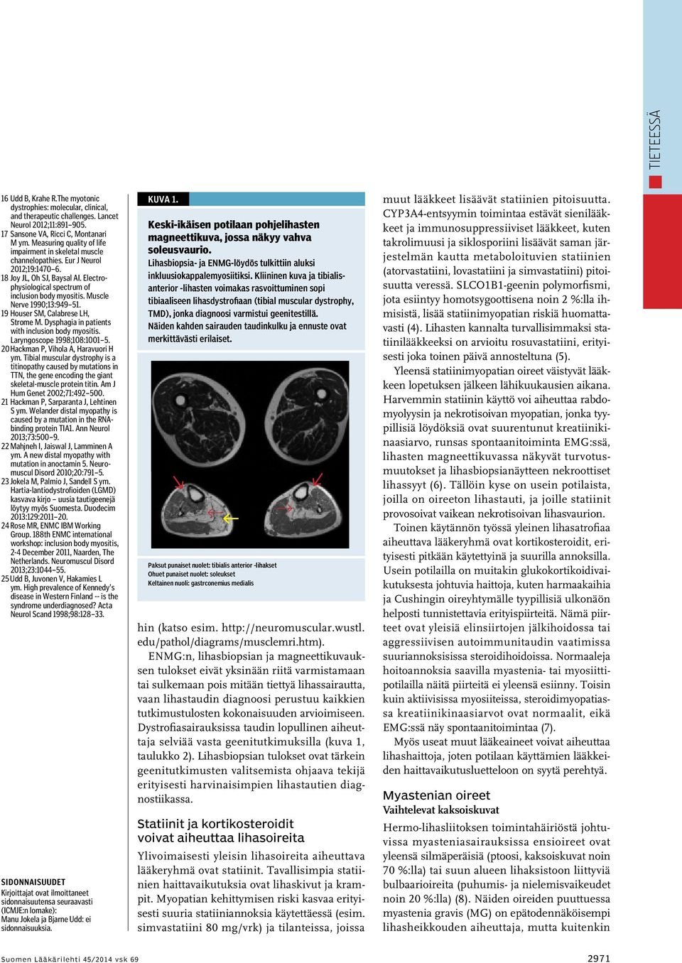 Muscle Nerve 1990;13:949 51. 19 Houser SM, Calabrese LH, Strome M. Dysphagia in patients with inclusion body myositis. Laryngoscope 1998;108:1001 5. 20 Hackman P, Vihola A, Haravuori H ym.