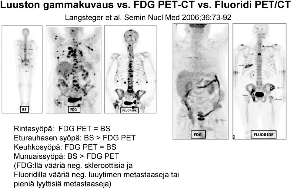 PET Keuhkosyöpä: FDG PET = BS Munuaissyöpä: BS > FDG PET (FDG:llä vääriä neg.