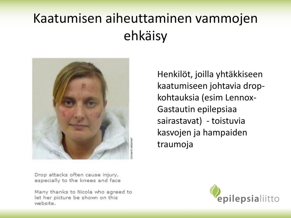 dropkohtauksia (esim Lennox- Gastautin epilepsiaa