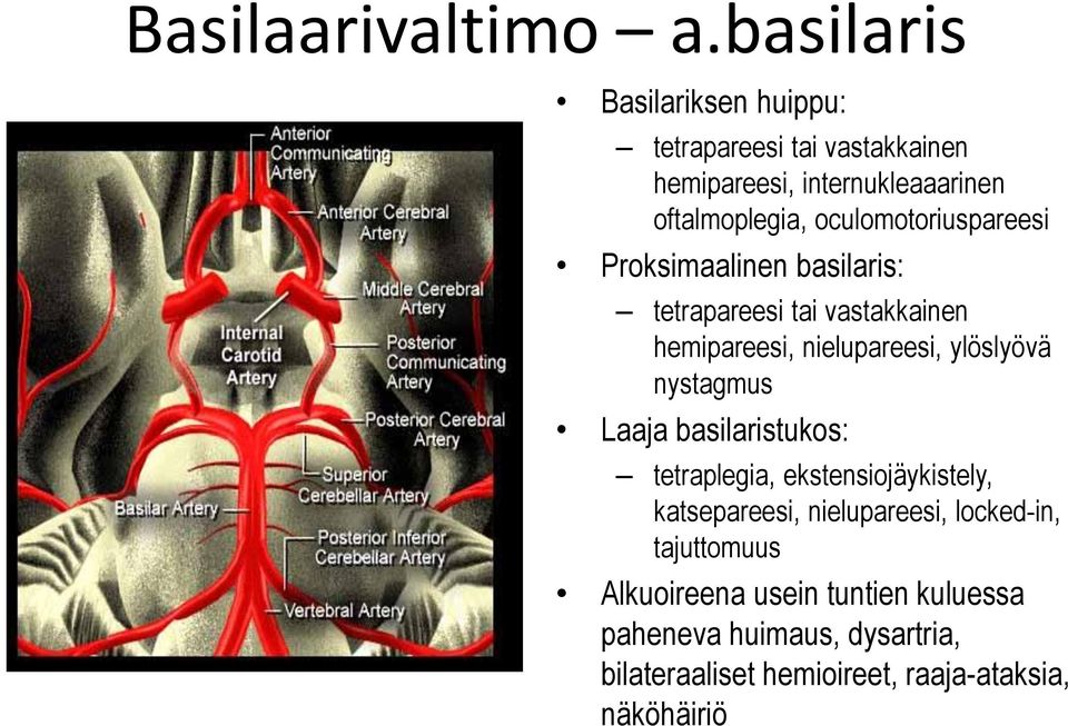 oculomotoriuspareesi Proksimaalinen basilaris: tetrapareesi tai vastakkainen hemipareesi, nielupareesi, ylöslyövä