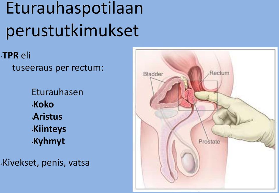 tuseeraus per rectum: